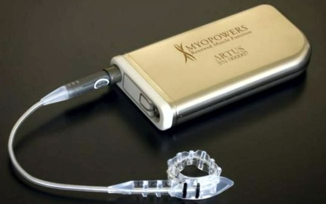 Affluent Medical's Artus artificial sphincter for urinary incontinence